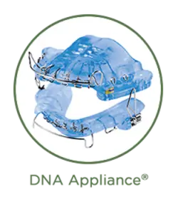 This image depicts a DNA Appliance , which is an orthodontic device used in dental treatment.