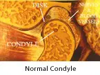 Normal Condyle